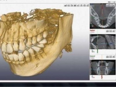 堺市北区/MYデンタルクリニック/CT