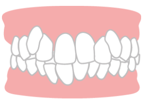 MYデンタルクリニックインプラント