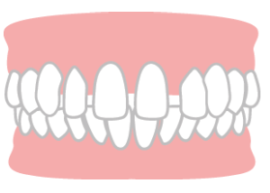MYデンタルクリニックインプラント