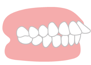 MYデンタルクリニックインプラント