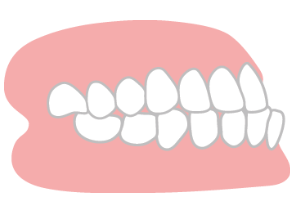 MYデンタルクリニックインプラント