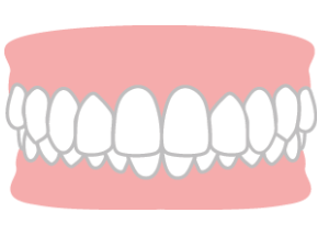 MYデンタルクリニックインプラント