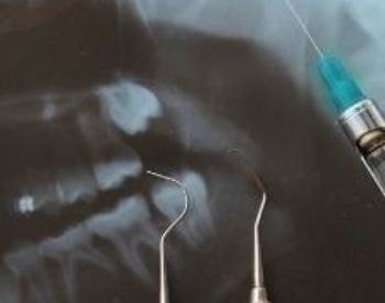 ＭＹデンタルクリニック/虫歯治療