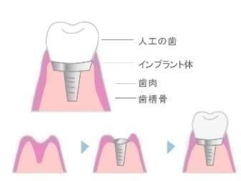 MYデンタルクリニック/堺市北区歯科