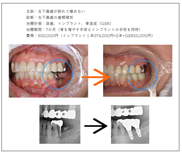 ＭＹデンタル審美歯科